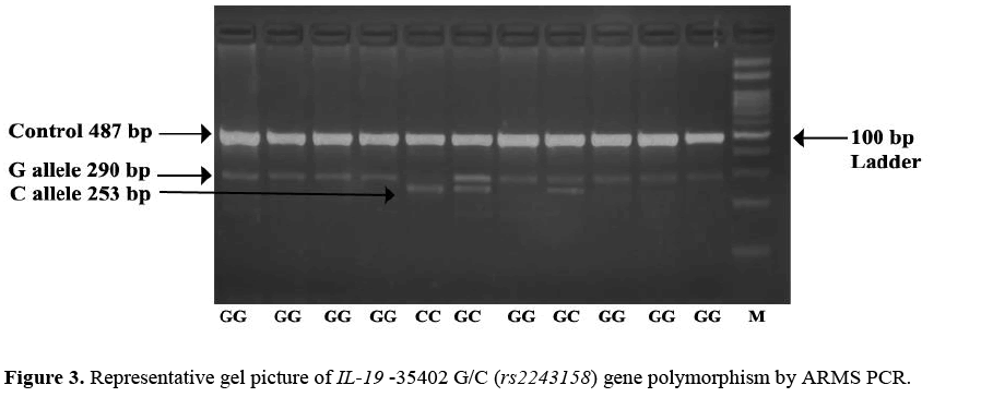 geneticsmr-Molecular-insights-gel-picture